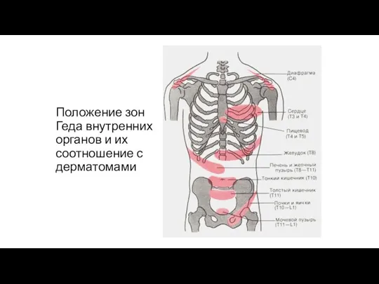 Положение зон Геда внутренних органов и их соотношение с дерматомами