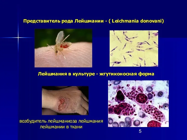 Лейшмания в культуре - жгутиконосная форма Представитель рода Лейшмании -