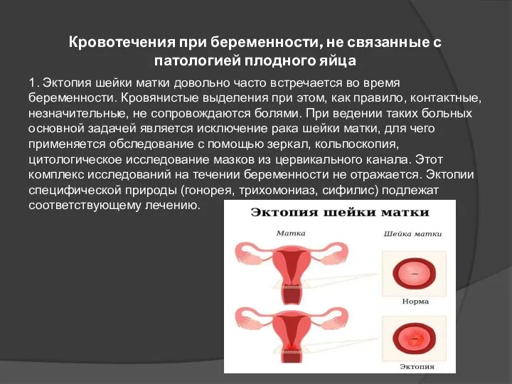 Кровотечения при беременности, не связанные с патологией плодного яйца 1.