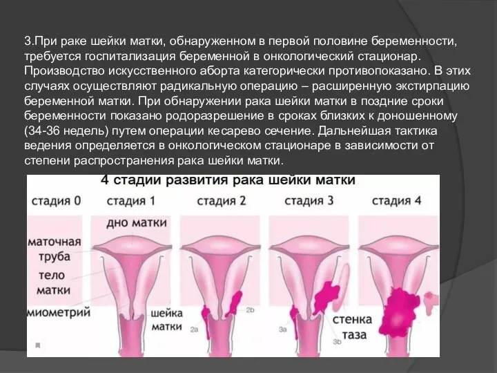 3.При раке шейки матки, обнаруженном в первой половине беременности, требуется