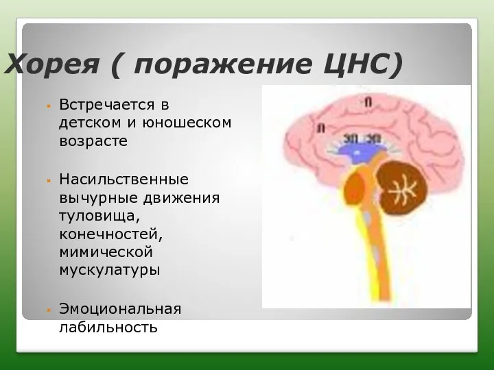 Хорея ( поражение ЦНС) Встречается в детском и юношеском возрасте Насильственные вычурные движения