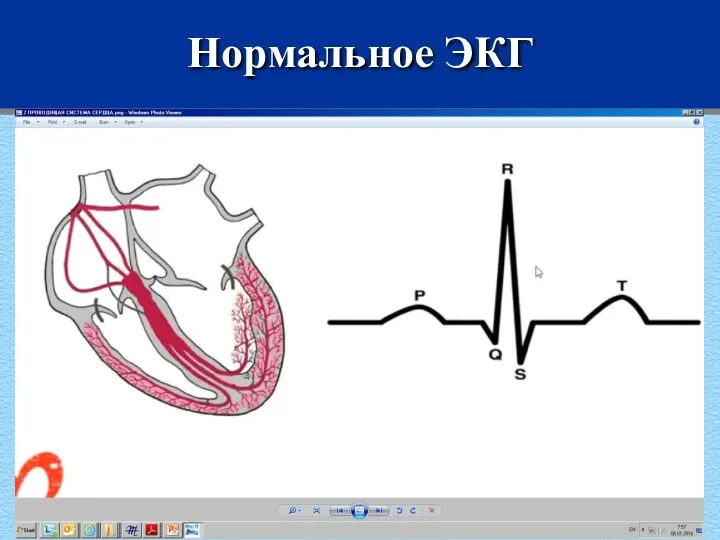 Нормальное ЭКГ