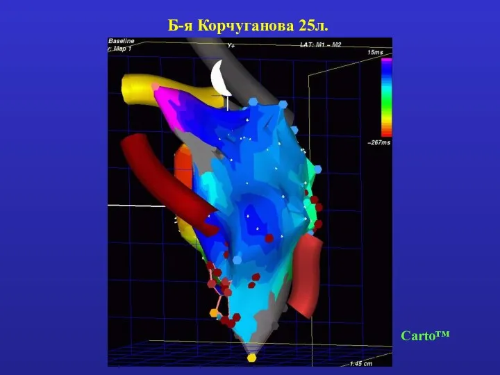 Б-я Корчуганова 25л. Carto™