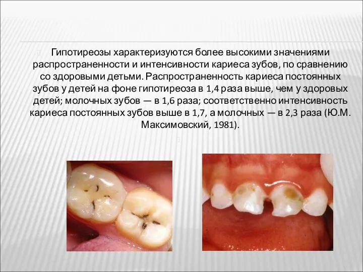 Гипотиреозы характеризуются более высокими значениями распространенности и интенсивности кариеса зубов,