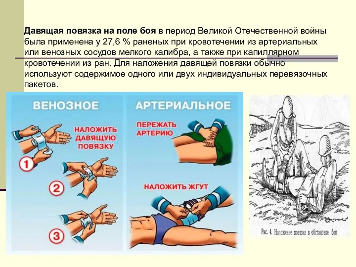 Давящая повязка на поле боя в период Великой Отечественной войны