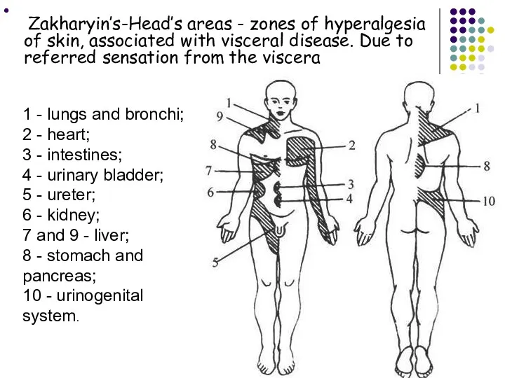 Zakharyin’s-Head’s areas - zones of hyperalgesia of skin, associated with