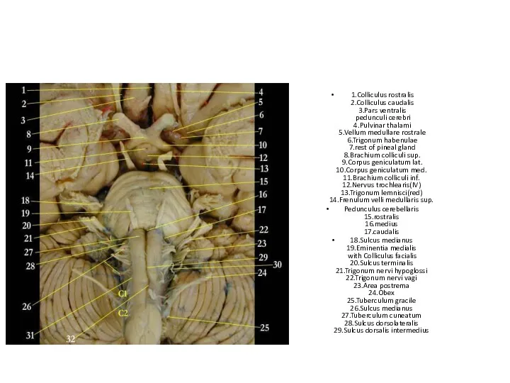 1.Colliculus rostralis 2.Colliculus caudalis 3.Pars ventralis pedunculi cerebri 4.Pulvinar thalami