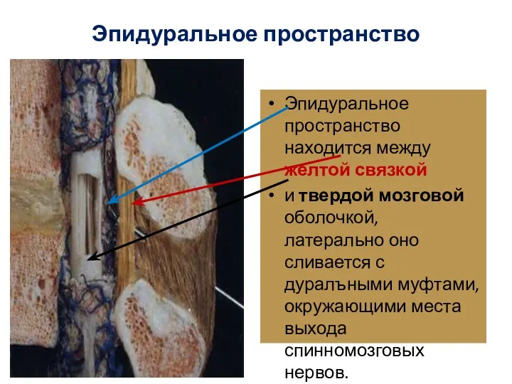 Эпидуральное пространство Эпидуральное пространство находится между желтой связкой и твердой