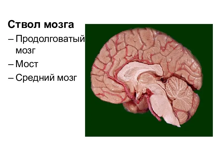 Ствол мозга Продолговатый мозг Мост Средний мозг