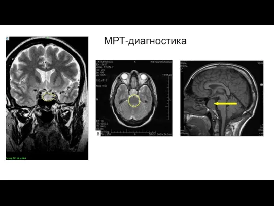 МРТ-диагностика