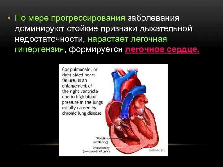 По мере прогрессирования заболевания доминируют стойкие признаки дыхательной недостаточности, нарастает легочная гипертензия, формируется легочное сердце.