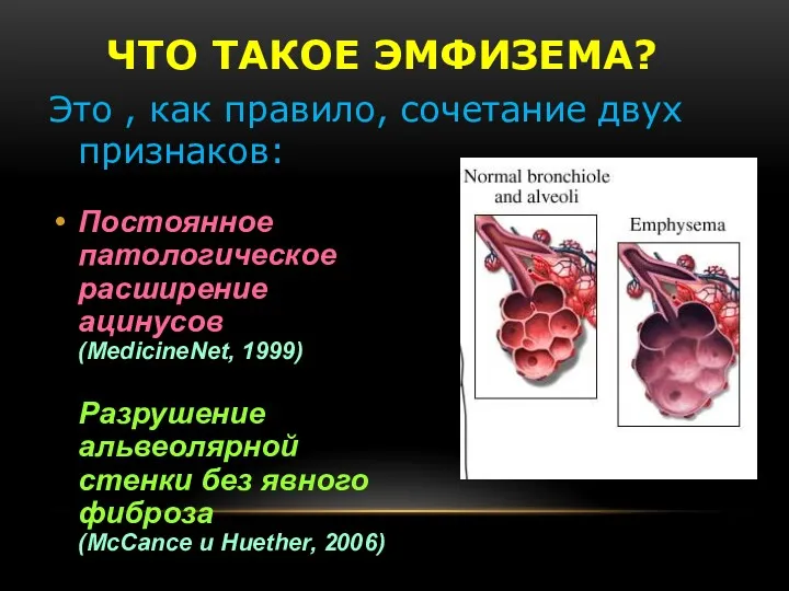 ЧТО ТАКОЕ ЭМФИЗЕМА? Постоянное патологическое расширение ацинусов (MedicineNet, 1999) Разрушение