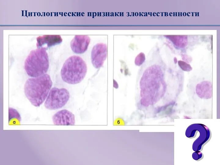 Цитологические признаки злокачественности