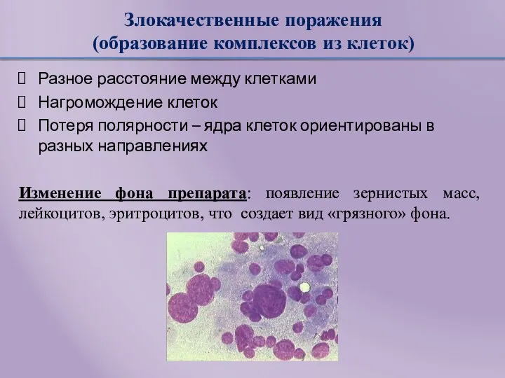 Злокачественные поражения (образование комплексов из клеток) Разное расстояние между клетками