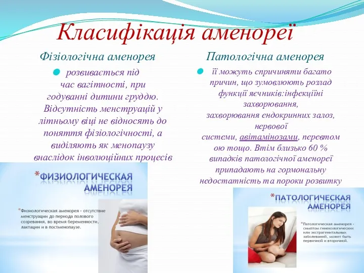 Класифікація аменореї Фізіологічна аменорея Патологічна аменорея розвивається під час вагітності,