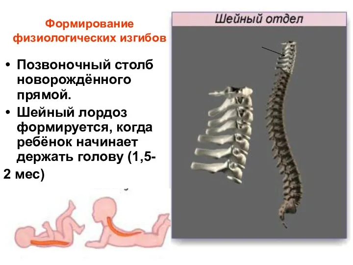 Формирование физиологических изгибов Позвоночный столб новорождённого прямой. Шейный лордоз формируется,