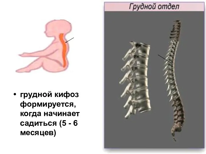 грудной кифоз формируется, когда начинает садиться (5 - 6 месяцев)