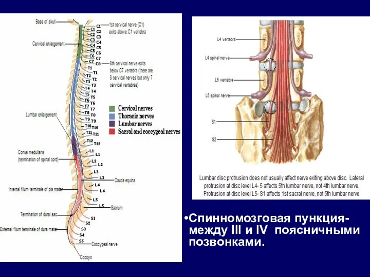 Спинномозговая пункция- между III и IV поясничными позвонками.