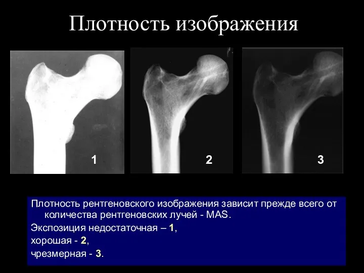 Плотность изображения Плотность рентгеновского изображения зависит прежде всего от количества рентгеновских лучей -