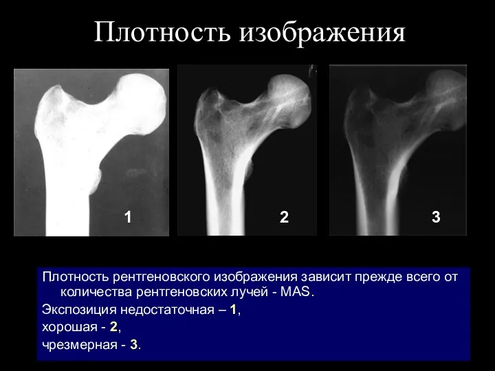 Плотность изображения Плотность рентгеновского изображения зависит прежде всего от количества