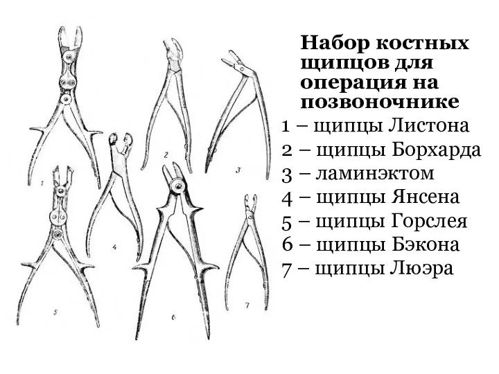 Набор костных щипцов для операция на позвоночнике 1 – щипцы