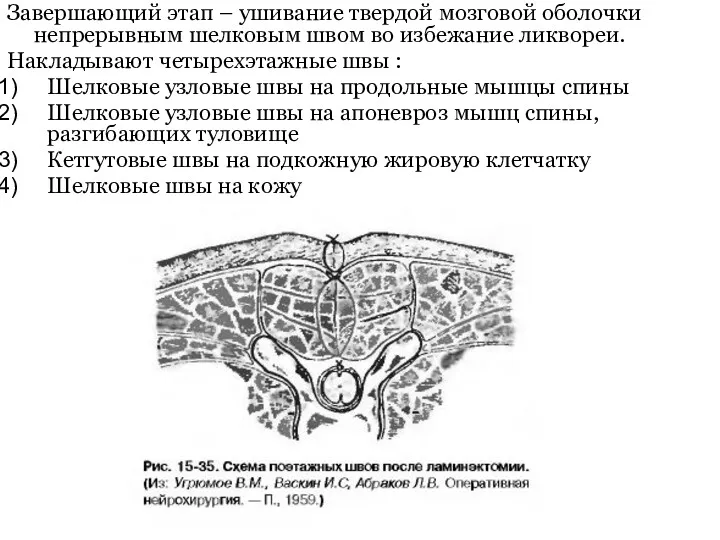 Завершающий этап – ушивание твердой мозговой оболочки непрерывным шелковым швом