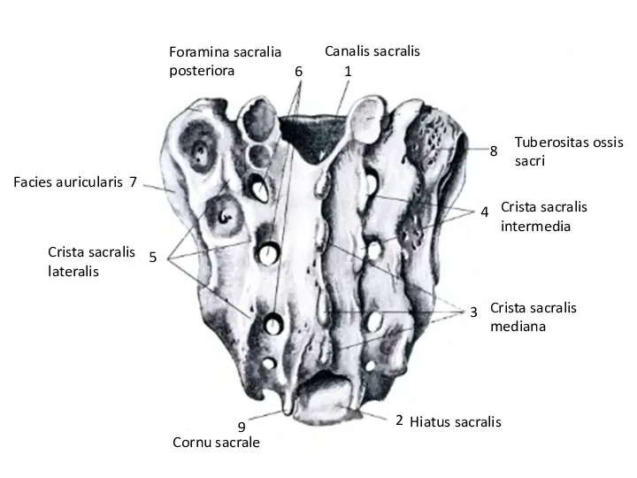 1 Canalis sacralis 2 Hiatus sacralis Crista sacralis mediana 3