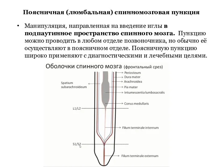 Поясничная (люмбальная) спинномозговая пункция Манипуляция, направленная на введение иглы в