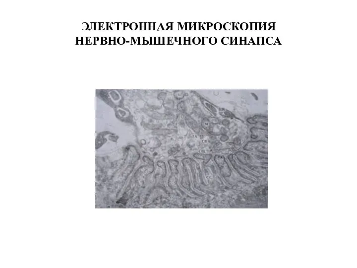 ЭЛЕКТРОННАЯ МИКРОСКОПИЯ НЕРВНО-МЫШЕЧНОГО СИНАПСА