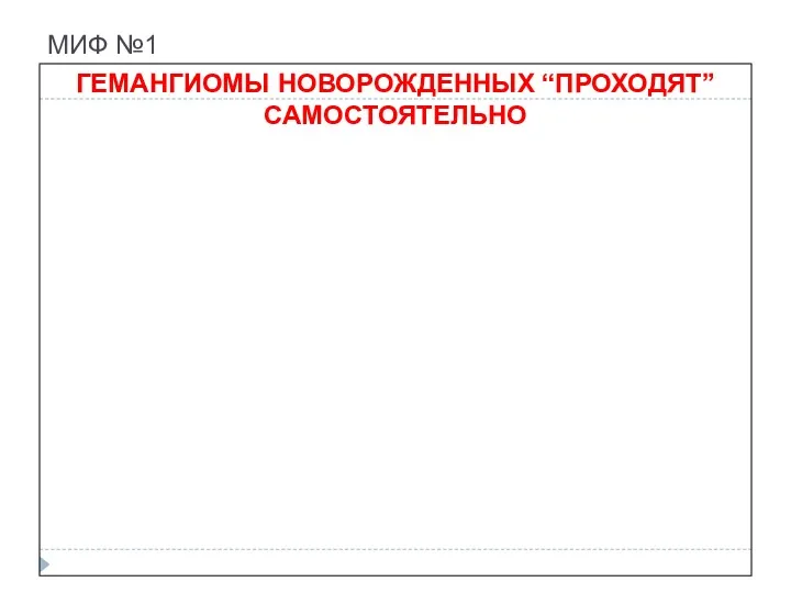 МИФ №1 ГЕМАНГИОМЫ НОВОРОЖДЕННЫХ “ПРОХОДЯТ” САМОСТОЯТЕЛЬНО