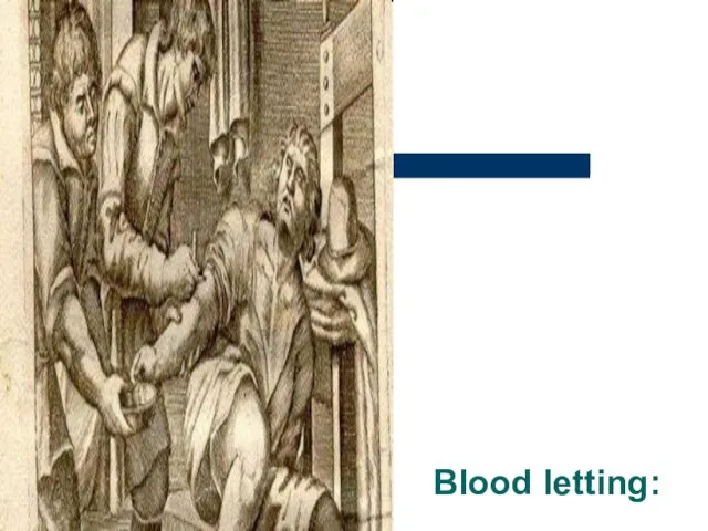 Blood letting: