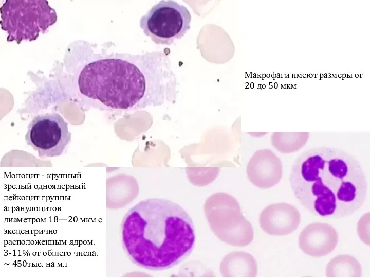 Моноцит - крупный зрелый одноядерный лейкоцит группы агранулоцитов диаметром 18—20