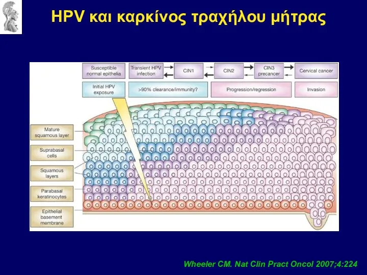 Wheeler CM. Nat Clin Pract Oncol 2007;4:224 HPV και καρκίνος τραχήλου μήτρας