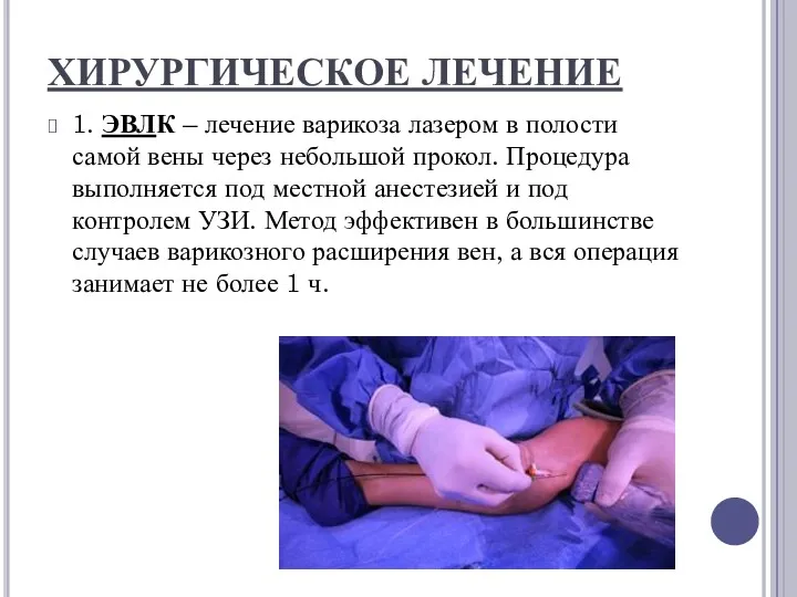 ХИРУРГИЧЕСКОЕ ЛЕЧЕНИЕ 1. ЭВЛК – лечение варикоза лазером в полости самой вены через