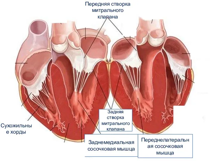 Передняя створка митрального клапана Сухожильные хорды Задняя створка митрального клапана