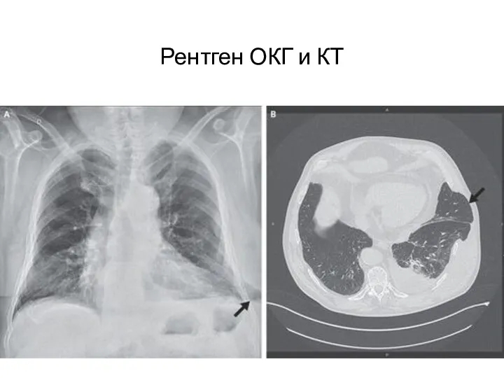 Рентген ОКГ и КТ