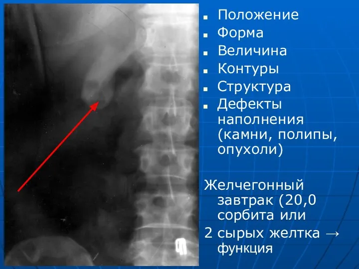 Положение Форма Величина Контуры Структура Дефекты наполнения (камни, полипы, опухоли)