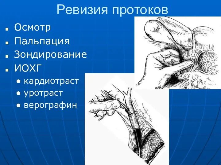 Ревизия протоков Осмотр Пальпация Зондирование ИОХГ кардиотраст уротраст верографин