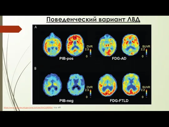 Поведенческий вариант ЛВД https://www.ncbi.nlm.nih.gov/pmc/articles/PMC5390934/ стр. 470