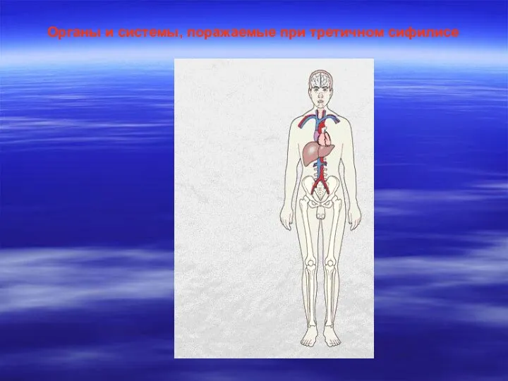 Органы и системы, поражаемые при третичном сифилисе