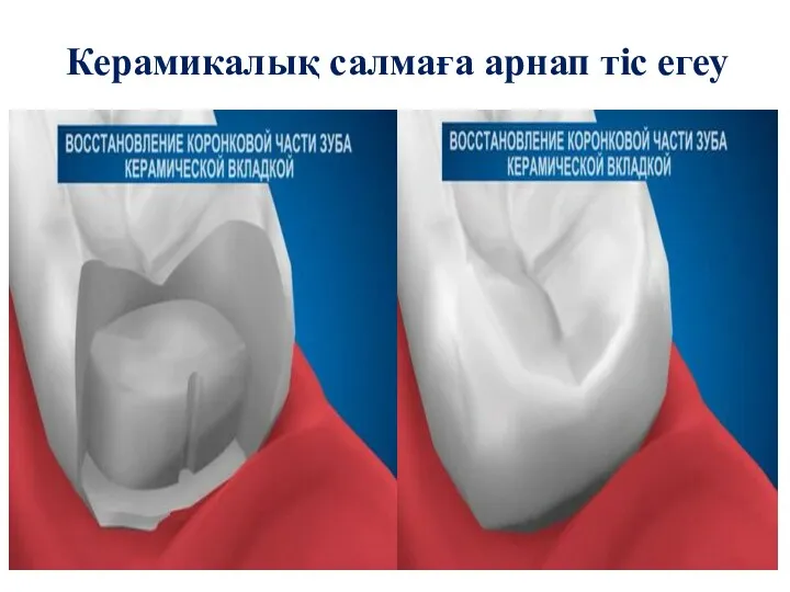 Керамикалық салмаға арнап тіс егеу