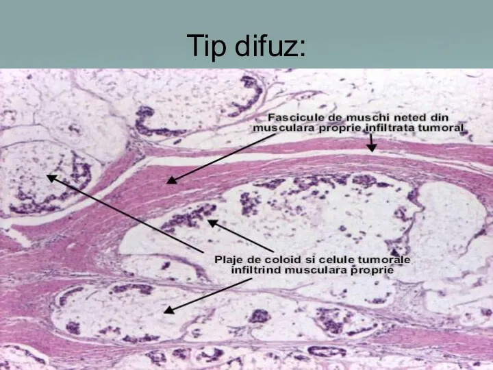 Tip difuz: