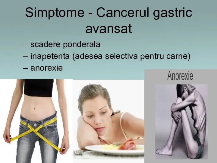 Simptome - Cancerul gastric avansat scadere ponderala inapetenta (adesea selectiva pentru carne) anorexie