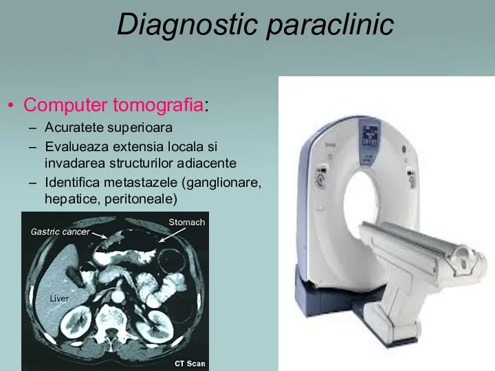 Diagnostic paraclinic Computer tomografia: Acuratete superioara Evalueaza extensia locala si