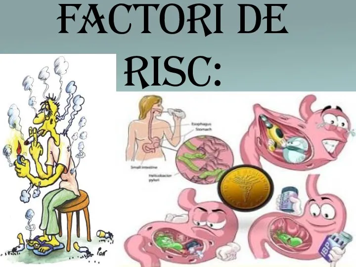 Factori de risc: