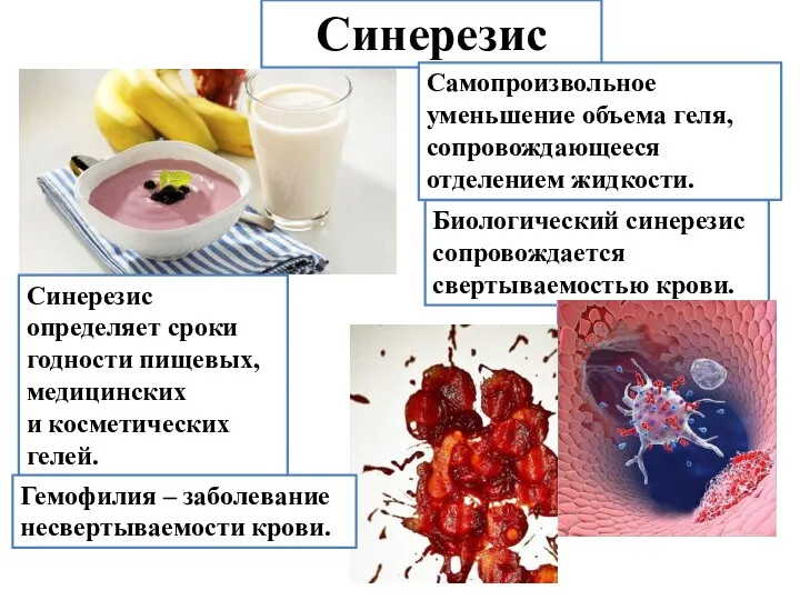 Синерезис Самопроизвольное уменьшение объема геля, сопровождающееся отделением жидкости. Синерезис определяет