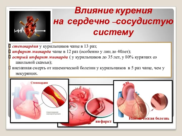 Влияние курения на сердечно –сосудистую систему стенокардия у курильщиков чаще