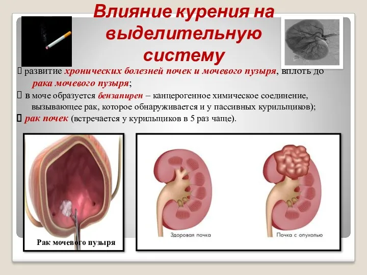 Влияние курения на выделительную систему развитие хронических болезней почек и