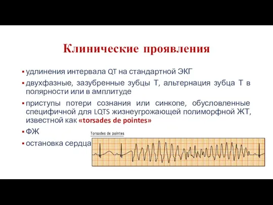 Клинические проявления удлинения интервала QT на стандартной ЭКГ двухфазные, зазубренные