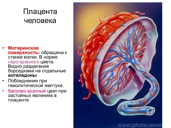 Плацента человека Материнская поверхность- обращена к стенке матки. В норме